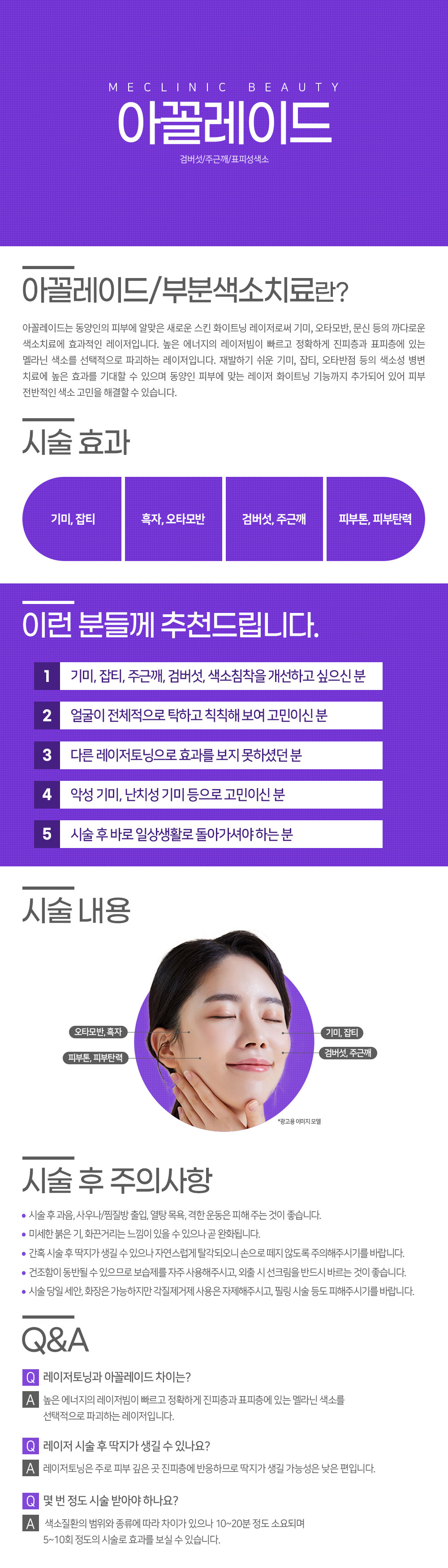 아꼴레이드 컨텐츠