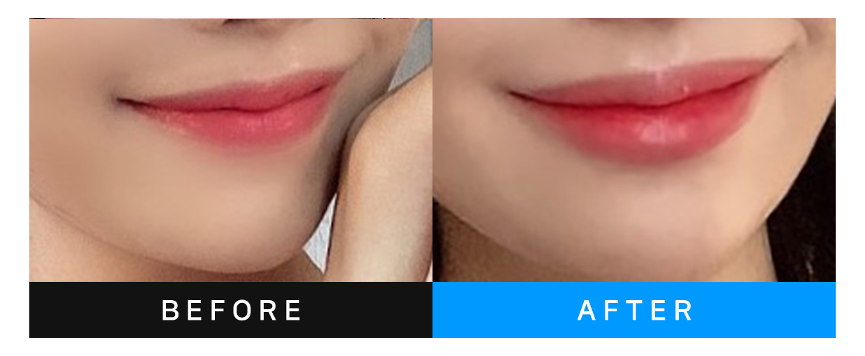 before&after