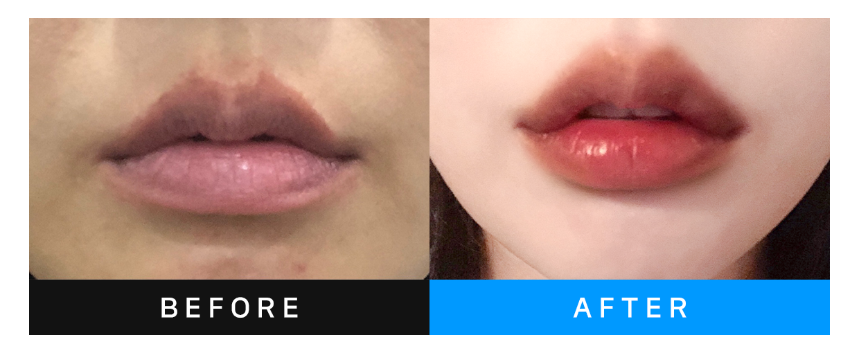 before&after