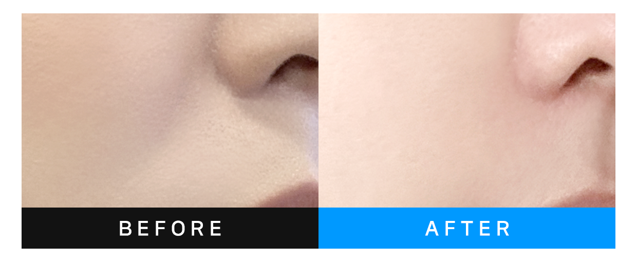 before&after