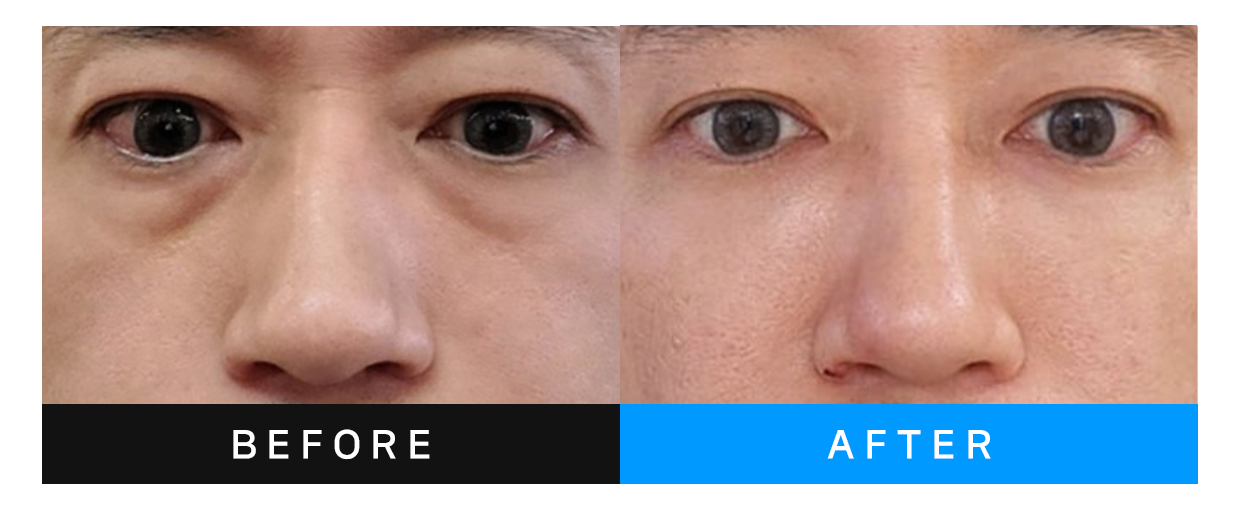 before&after