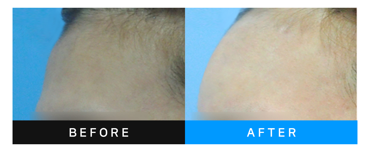before&after